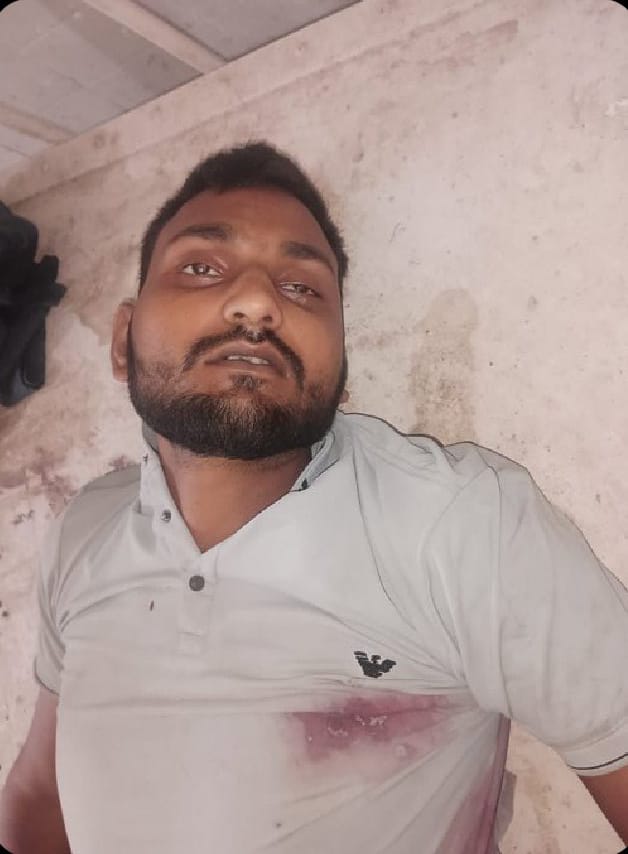 यूपी के अयोध्या में एनकाउंटरमहिला कांस्टेबल पर हमले के , आरोपी अनीश खान मुठभेड़ में ढेर